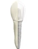Graphic showing cross-section image of outside and inside of a dental implant